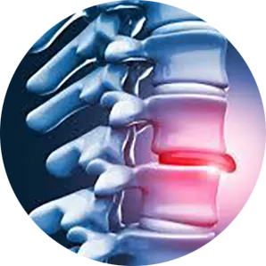 Disc Injury Treatment Near Me in Midland, TX. Chiropractor for Disc Injury Relief.