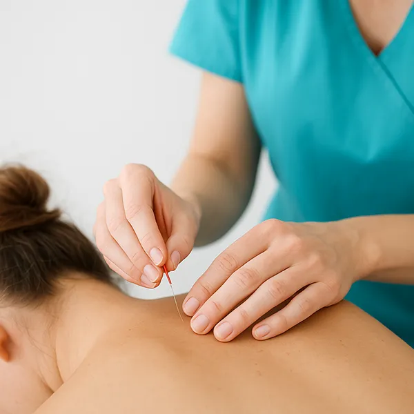 Dry Needling Therapy Near Me in Midland, TX. Chiropractor For Dry Needling.
