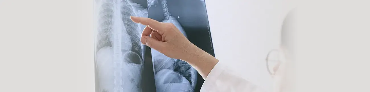 Scoliosis Treatment Near Me in Midland, TX. Chiropractor for Scoliosis Pain Relief.